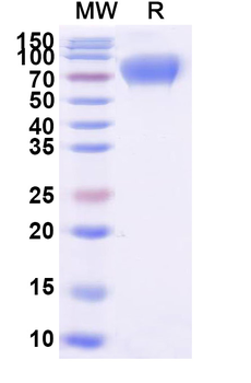 Recombinant Human CD226/DNAM-1 Protein, C-Fc