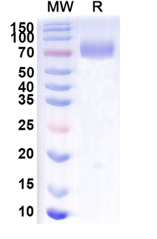 Recombinant Mouse CD6 Protein, C-Fc
