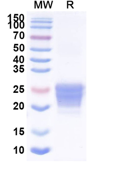 Recombinant Mouse CD70 Protein, C-His