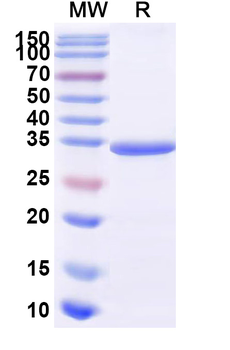 Recombinant Human CD117/KIT Protein, C-Fc