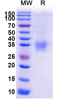 Recombinant Mouse EFNA3 Protein, C-His