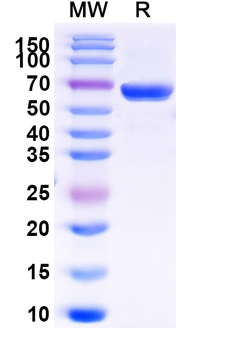 Recombinant Mouse EFNB1 Protein, C-Fc