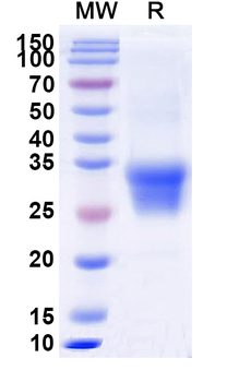 Recombinant Mouse EFNB1 Protein, C-His