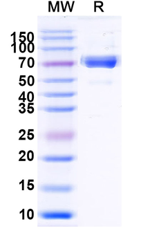 Recombinant Mouse ERBB3/HER3 Protein, C-His