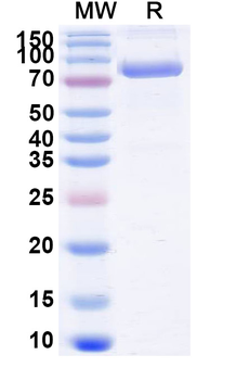 Recombinant Mouse CD71/TFRC Protein, C-His
