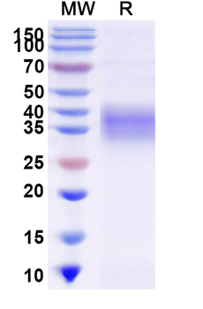 Recombinant Mouse CD120a/TNFRSF1A Protein, C-His