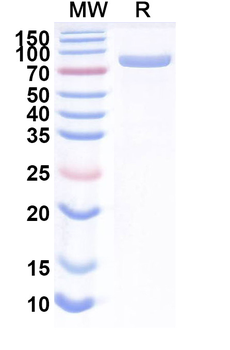 Recombinant Mouse TF/Serotransferrin Protein, C-His