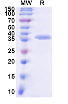 Recombinant Human SLC6A5 Protein, N-GST & C-His