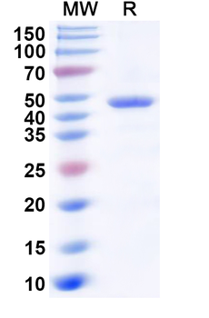Recombinant Human ADH7 Protein, N-His