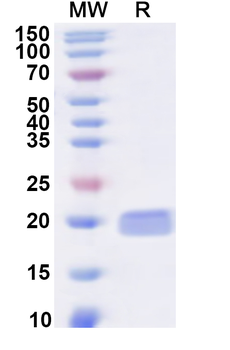 Recombinant Human CDKN2C Protein, N-His