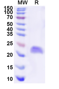 Recombinant Human CSRP3 Protein, N-His