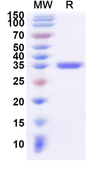 Recombinant Human PTPN5 Protein, N-His