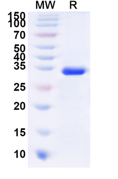 Recombinant Human ADIPOR1 Protein, N-His-KSI