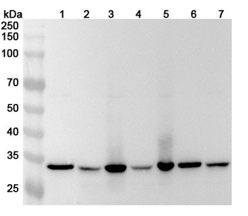 TOMM34 Polyclonal Antibody