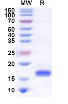 Recombinant Human TREML2 Protein, N-His