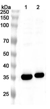 Human TREML2 Polyclonal Antibody