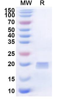 Recombinant Human CD300E Protein, N-His