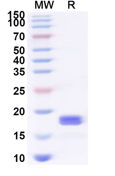 Recombinant Human CD300LB Protein, N-His