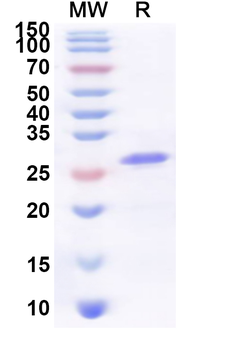 Recombinant Human CD300LG Protein, N-His