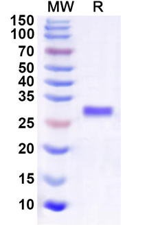 Human IGBP1 Recombinant Protein (N-His)