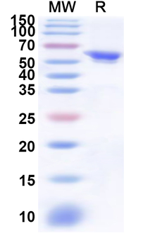 Recombinant Human ITK Protein, N-His