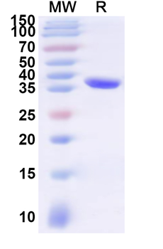 Recombinant Human PRAP1 Protein, N-His-KSI