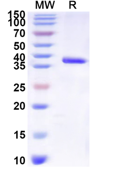 Recombinant Human ERVK-6 Protein, N-His