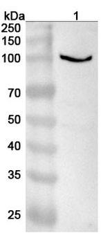 KANK1 Polyclonal Antibody