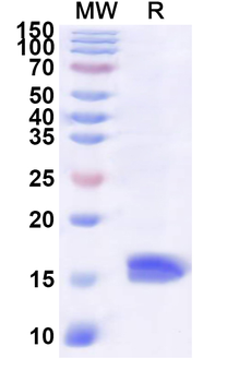 Recombinant Human PEA15 Protein, N-His