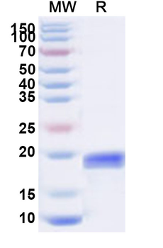 Recombinant Human LAIR2 Protein, N-His