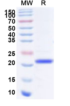 Recombinant Human PHLDA2 Protein, N-His