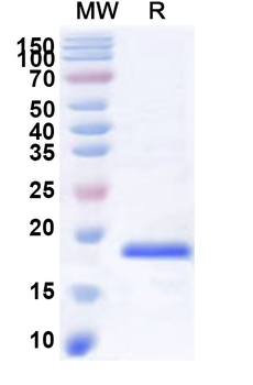 Recombinant Human SLC34A1 Protein, N-His
