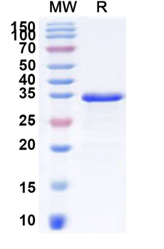 Recombinant Human CXCR2 Protein, N-His-KSI