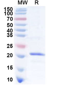 Recombinant Human CD300A Protein, N-His