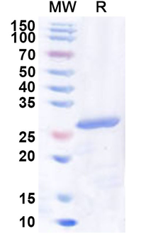 Recombinant Human NR2F6 Protein, N-His