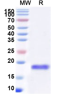 Recombinant Human EIF1AX Protein, N-His