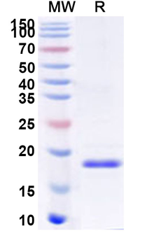 Recombinant Human ZG16 Protein, N-His