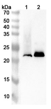 Rat LCN2 Polyclonal Antibody