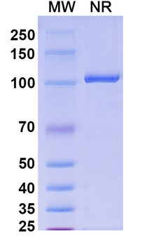 Influenza B virus Hemagglutinin/HA Nanobody Antibody