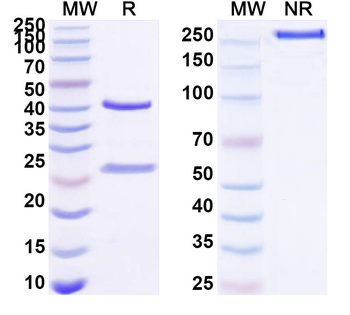 DENV-2 Envelope protein E Antibody