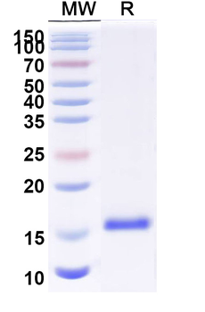 Clostridium botulinum botA/BoNT Nanobody Antibody