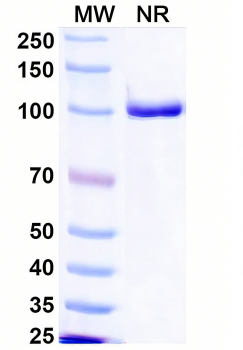 PRRSV NP/Nucleoprotein Antibody