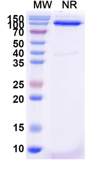 Oropouche virus/OROV Glycoprotein G1 Nanobody Antibody