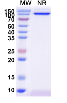 Oropouche virus/OROV Glycoprotein G1 Nanobody Antibody