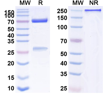 Human CD25/IL2RA Monoclonal Antibody