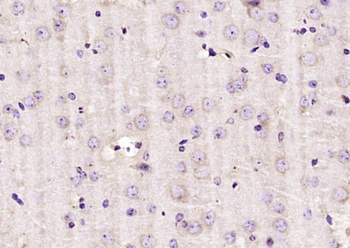 DAD1 Rabbit Polyclonal Antibody