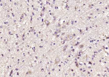 DAD1 Rabbit Polyclonal Antibody