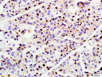 RNF7 Rabbit Polyclonal Antibody