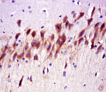 ILP2 Rabbit Polyclonal Antibody