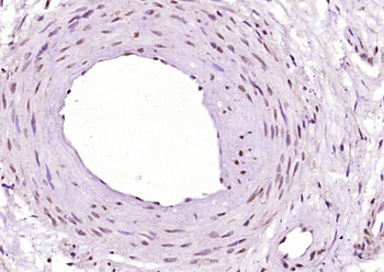CIRBP Rabbit Polyclonal Antibody